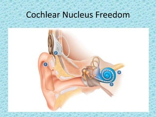 Cochlear Nucleus Freedom
 