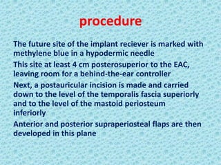 procedure
The future site of the implant reciever is marked with
methylene blue in a hypodermic needle
This site at least 4 cm posterosuperior to the EAC,
leaving room for a behind-the-ear controller
Next, a postauricular incision is made and carried
down to the level of the temporalis fascia superiorly
and to the level of the mastoid periosteum
inferiorly
Anterior and posterior supraperiosteal flaps are then
developed in this plane
 