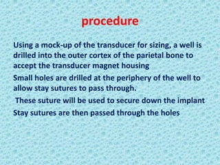 procedure
Using a mock-up of the transducer for sizing, a well is
drilled into the outer cortex of the parietal bone to
accept the transducer magnet housing
Small holes are drilled at the periphery of the well to
allow stay sutures to pass through.
These suture will be used to secure down the implant
Stay sutures are then passed through the holes
 