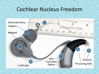 Cochlear Nucleus Freedom
 