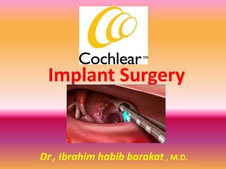 Implant Surgery


Dr , Ibrahim habib barakat , M.D.
 