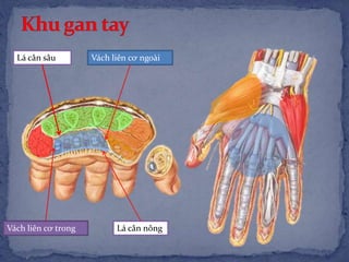 Lá cân sâu
Lá cân nông
Vách liên cơ ngoài
Vách liên cơ trong
 