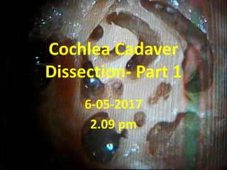 Cochlea Cadaver
Dissection- Part 1
12-05-2017
2.35 pm
 