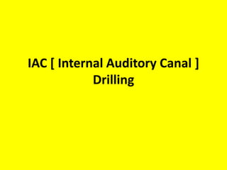 facial nerve in lateral part of IAC decompression is difficult even
in middle cranial fossa. It is between two solid bones of cochlea
& SSC
 