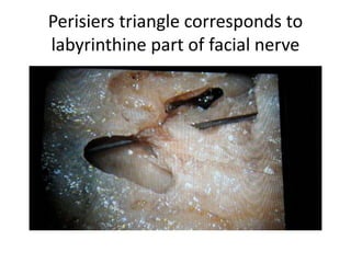 Observe metal probe in perisiers (
dangerous) triangle
 
