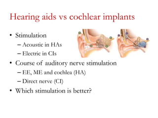 Cochlea implant candidacy