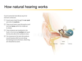 How natural hearing works 