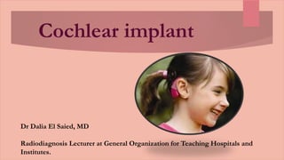 Cochlear implant
Dr Dalia El Saied, MD
Radiodiagnosis Lecturer at General Organization for Teaching Hospitals and
Institutes.
 