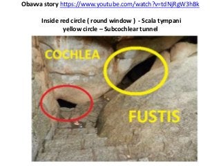 Obavva story https://www.youtube.com/watch?v=tdNjRgW3hBk
Inside red circle ( round window ) - Scala tympani
yellow circle – Subcochlear tunnel
 