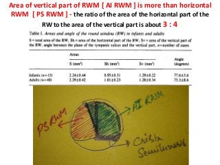 Area of vertical part of RWM [ AI RWM ] is more than horizontal
RWM [ PS RWM ] - the ratio of the area of the horizontal part of the
RW to the area of the vertical part is about 3 : 4
 
