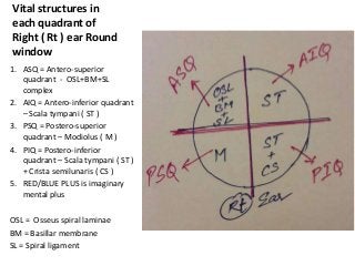 Vital structures in
each quadrant of
Right ( Rt ) ear Round
window
1. ASQ = Antero-superior
quadrant - OSL+BM+SL
complex
2. AIQ = Antero-inferior quadrant
– Scala tympani ( ST )
3. PSQ = Postero-superior
quadrant – Modiolus ( M )
4. PIQ = Postero-inferior
quadrant – Scala tympani ( ST )
+ Crista semilunaris ( CS )
5. RED/BLUE PLUS is imaginary
mental plus
OSL = Osseus spiral laminae
BM = Basillar membrane
SL = Spiral ligament
 