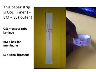 This paper strip
is OSL ( inner ) +
BM + SL ( outer )
OSL = osseus spiral
laminae
BM = basillar
membrane
SL = spiral ligament
 
