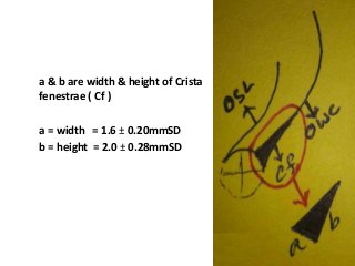 a & b are width & height of Crista
fenestrae ( Cf )
a = width = 1.6 ± 0.20mmSD
b = height = 2.0 ± 0.28mmSD
 
