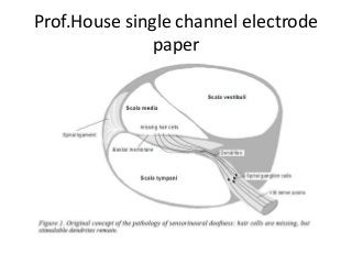Prof.House single channel electrode
paper
 