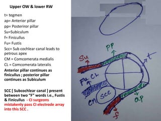 Pars ascendens associated with Pre-cochlear carotid [ vertical
part of intra-temporal carotid ]
Pars = Part
 