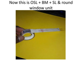 Diagrammatic representation of
the intracochlear electrode
array (red) and the division of the
cochlea into five segments.
The beginning of
segment 1 corresponded
to the RW membrane,
while that of segments 2
and 4 indicated the
surface where the
modiolus was no longer
visualized. In the latter
two segments, the
electrode could be
visualized in the
transverse orientation.
 