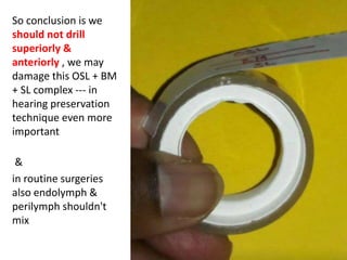 • The surgical implications are
1) This triangle contains labyrinthine part of FN.
2) During transotic or transcochlear approaches surgeon should respect this triangle and drill carefully
to avoid injury to FN.
3) Clinically labyrinthine part consists of two segments a meatal segment of nerve, labyrinthine part of
nerve. total length of this nerve is 3 to 5 mm. Anteriorly we can see these parts clearly through this
triangle.
4) 1st part of FN passes close to lower border of precochlear HFN towards anterior end of oval window
in this triangle.
5) Irregular drilling of cochlea in this triangle damages FN That is why it is called DANGERS TRIANGLE.
6) During trans meatal endoscopic dissection of IAC, this triangle important for identification of nerves
7) Translabyrinthine approach visualises posterior surface of 1st part of FN, in transcochlear approaches
the anterior surface of the nerve is exposed. In transottic approaches 270 to 320 degrees of 1 st part of
FN is exposed.
8)Observe closely the labyrinthine part of FN there is a constriction of labyrinthine segment and meatal
segment.
Facial nerve key points
1) Facial nerve changes direction 5 times during its course from brain stem to styloid foramen.
2) No other nerve in body covers such a long distance in bony canal
3) facial nerve contains 10000 axons that are responsible for the innervation of the face musculature
and also for the communications with other nerves human body
4) work with injured facial nerve requires lot of patience.
 