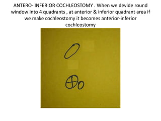 Below RW devided into 4 quadrants
 