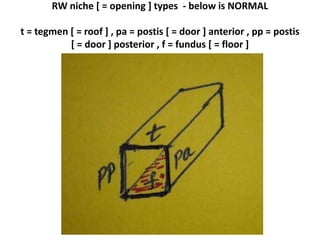 RW niche NORMAL parts
 