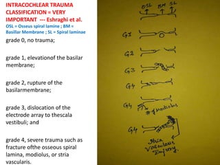 Round Window Grades - FOUR grades
- through Facial recess approach
 