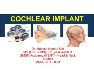 COCHLEAR IMPLANT
Dr. Mukesh Kumar Sah
MS (ORL- HNS), 3rd year resident
GMSM Academy of ENT – Head & Neck
Studies
MMC-TUTH, IOM
 