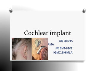 Cochlear implant
DR DISHA
SHARMA
JR ENT-HNS
IGMC,SHIMLA
 