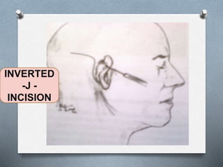 Cochlear implant 1 | PPTX