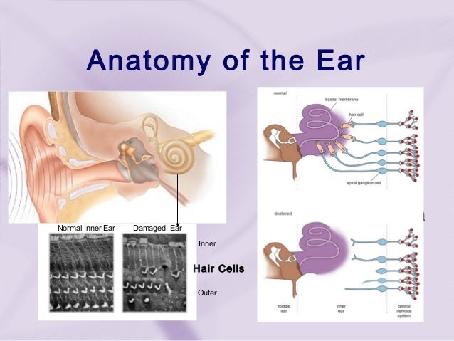 Cochlear implant (3)