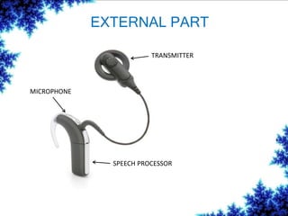 EXTERNAL PART
MICROPHONE
SPEECH PROCESSOR
TRANSMITTER
 
