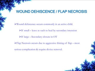 WOUND DEHISCENCE / FLAP NECROSIS
Wound dehiscence occurs commonly in an active child.
If small – leave as such to heal by secondary intension
If large – Secondary closure in OT
Flap Necrosis occurs due to aggressive thining of flap – most
serious complication & require device removal.
 