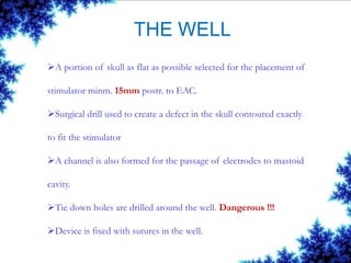 THE WELL
A portion of skull as flat as possible selected for the placement of
stimulator minm. 15mm postr. to EAC.
Surgi...