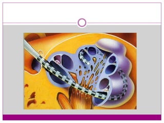 Recent Advances in Cochlear Implant Candidacy | PPSX