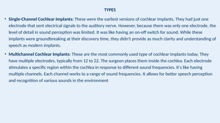 TYPES
• Single-Channel Cochlear Implants: These were the earliest versions of cochlear implants. They had just one
electrode that sent electrical signals to the auditory nerve. However, because there was only one electrode, the
level of detail in sound perception was limited. It was like having an on-off switch for sound. While these
implants were groundbreaking at their discovery time, they didn't provide as much clarity and understanding of
speech as modern implants.
• Multichannel Cochlear Implants: These are the most commonly used type of cochlear implants today. They
have multiple electrodes, typically from 12 to 22. The surgeon places them inside the cochlea. Each electrode
stimulates a specific region within the cochlea in response to different sound frequencies. It's like having
multiple channels. Each channel works to a range of sound frequencies. It allows for better speech perception
and recognition of various sounds in the environment
 
