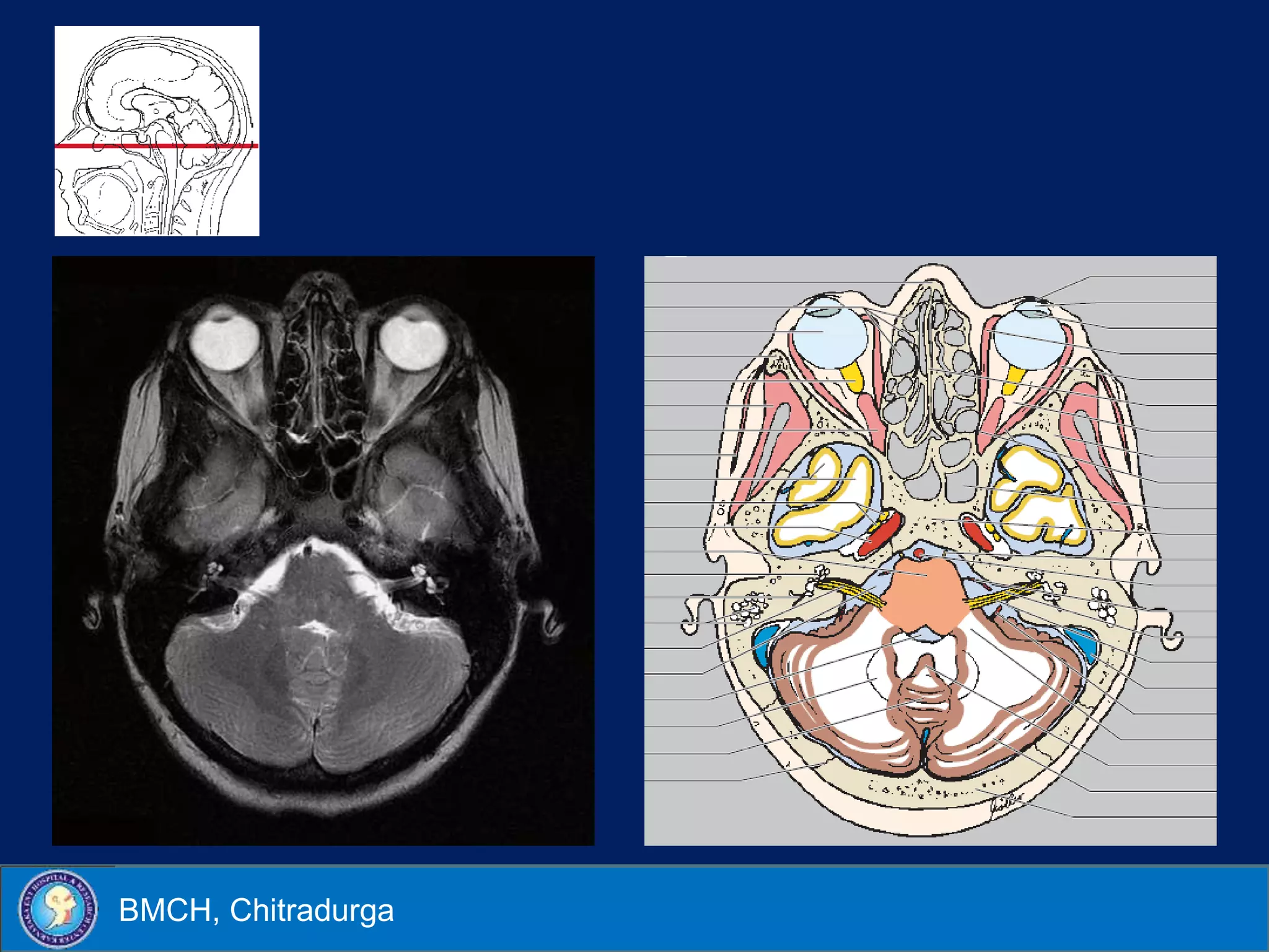 Cochlear implant imaging | PPSX