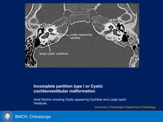 Cochlear implant imaging | PPSX