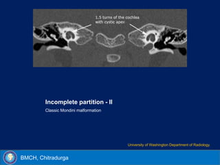 Cochlear implant imaging | PPSX