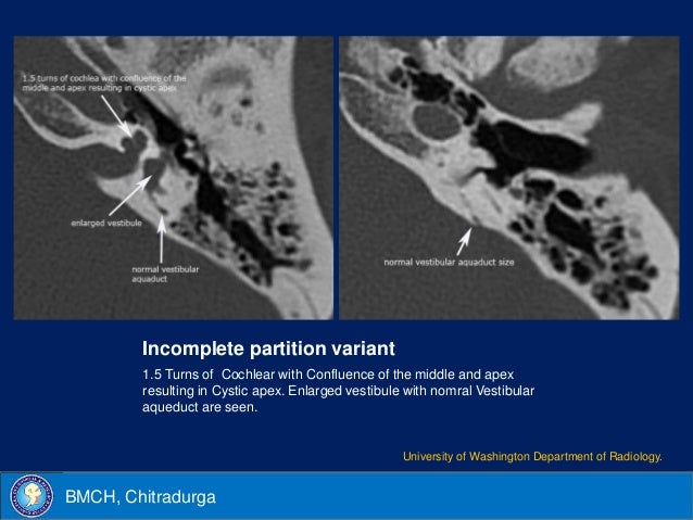 Cochlear implant imaging