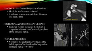 Modulus Cochleae Cochlear implant imaging, radiological features | PPTX
