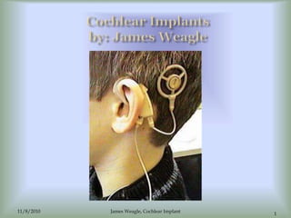 11/8/2010
1
James Weagle, Cochlear Implant
 