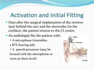 Cochlear Implementation Cochlear Implantation Process, Performance, and Culture | PPT