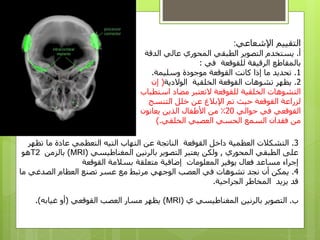 ‫التقييم‬‫اإلشعاعي‬:
‫أ‬.‫يستخدم‬‫الد‬ ‫عالي‬ ‫المحوري‬ ‫الطبقي‬ ‫التصوير‬‫قة‬
‫للقوقعة‬ ‫الرقيقة‬ ‫بالمقاطع‬‫في‬:
1.‫تحديد‬‫إذا‬ ‫ما‬‫كانت‬‫موجودة‬ ‫القوقعة‬‫وسليمة‬.
2.‫يظهر‬‫تشوهات‬‫الوالدية‬ ‫الخلقية‬ ‫القوقعة‬(‫إن‬
‫التشوهات‬‫للقوقعة‬ ‫الخلقية‬‫اس‬ ‫مضاد‬ ‫التعتبر‬‫تطباب‬
‫تم‬ ‫حيث‬ ‫القوقعة‬ ‫لزراعة‬‫التنس‬ ‫خلل‬ ‫عن‬ ‫اإلبالغ‬‫ج‬
‫في‬ ‫القوقعي‬‫حوالي‬20‫يعانون‬ ‫الذين‬ ‫األطفال‬ ‫من‬ ٪
‫الخلقي‬ ‫العصبي‬ ‫الحسي‬ ‫السمع‬ ‫فقدان‬ ‫من‬).
3.‫ت‬ ‫ما‬ ‫عادة‬ ‫التعظمي‬ ‫التيه‬ ‫التهاب‬ ‫عن‬ ‫الناتجة‬ ‫القوقعة‬ ‫داخل‬ ‫العظمية‬ ‫التشكالت‬‫ظهر‬
‫المحوري‬ ‫الطبقي‬ ‫على‬,‫المغناطيسي‬ ‫بالرنين‬ ‫التصوير‬ ‫يعتبر‬ ‫ولكن‬(MRI)‫بالزمن‬T2‫هو‬
‫المعلومات‬ ‫يوفير‬ ‫فعال‬ ‫مساعد‬ ‫إجراء‬‫متعلقة‬ ‫إضافية‬‫القوقعة‬ ‫بسالمة‬
4.‫الصدغي‬ ‫العظام‬ ‫تصنع‬ ‫عسر‬ ‫مع‬ ‫مرتبط‬ ‫الوجهي‬ ‫العصب‬ ‫في‬ ‫تشوهات‬ ‫نجد‬ ‫أن‬ ‫يمكن‬‫ما‬
‫الجراحية‬ ‫المخاطر‬ ‫يزيد‬ ‫قد‬.
‫ب‬.‫ي‬ ‫المغناطيسي‬ ‫بالرنين‬ ‫التصوير‬(MRI)‫القوقعي‬ ‫العصب‬ ‫مسار‬ ‫يظهر‬(‫غيابه‬ ‫أو‬.)
 