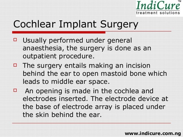 Advantages Of Cochlear Implant