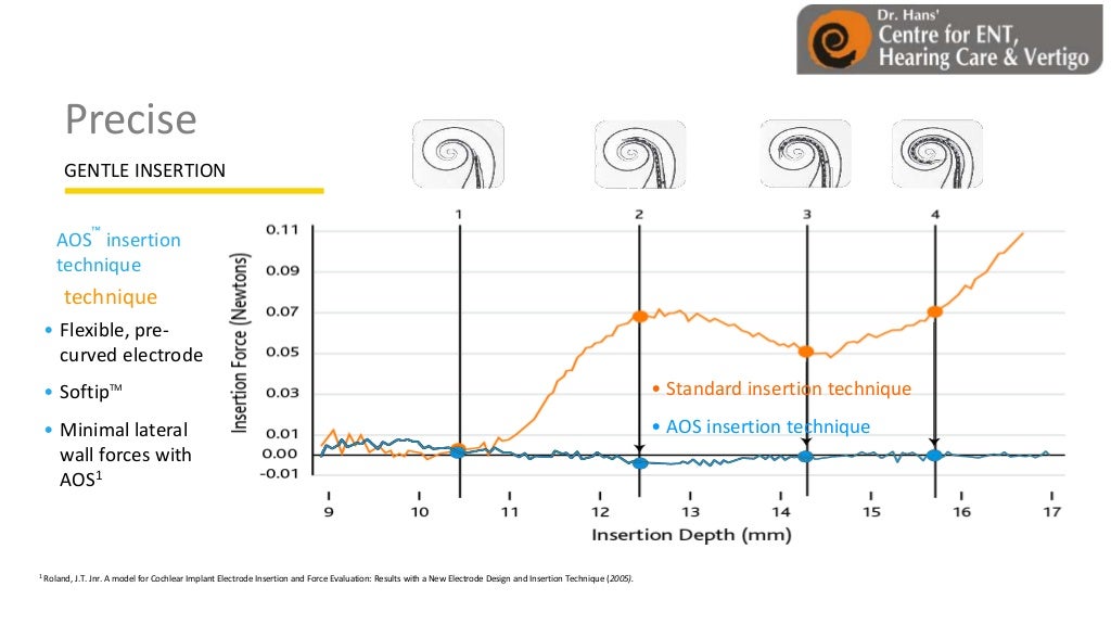 Cochlear implant systems