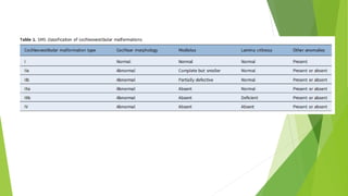 Cochlear malformations