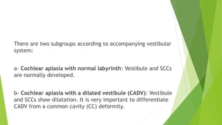 There are two subgroups according to accompanying vestibular
system:
a- Cochlear aplasia with normal labyrinth: Vestibule and SCCs
are normally developed.
b- Cochlear aplasia with a dilated vestibule (CADV): Vestibule
and SCCs show dilatation. It is very important to differentiate
CADV from a common cavity (CC) deformity.
 