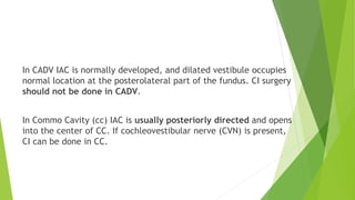 In CADV IAC is normally developed, and dilated vestibule occupies
normal location at the posterolateral part of the fundus. CI surgery
should not be done in CADV.
In Commo Cavity (cc) IAC is usually posteriorly directed and opens
into the center of CC. If cochleovestibular nerve (CVN) is present,
CI can be done in CC.
 