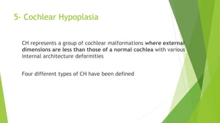 5- Cochlear Hypoplasia
CH represents a group of cochlear malformations where external
dimensions are less than those of a normal cochlea with various
internal architecture deformities
Four different types of CH have been defined
 