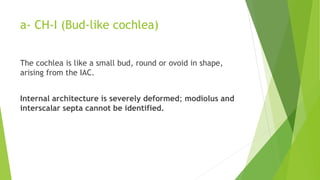 a- CH-I (Bud-like cochlea)
The cochlea is like a small bud, round or ovoid in shape,
arising from the IAC.
Internal architecture is severely deformed; modiolus and
interscalar septa cannot be identified.
 