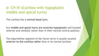 d- CH-IV (Cochlea with hypoplastic
middle and apical turns)
The cochlea has a normal basal turn,
but middle and apical turns are severely hypoplastic and located
anterior and medially rather than in their normal central position.
The labyrinthine segment of the facial nerve is usually located
anterior to the cochlea rather than in its normal location
 