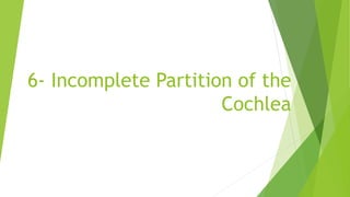 6- Incomplete Partition of the
Cochlea
 